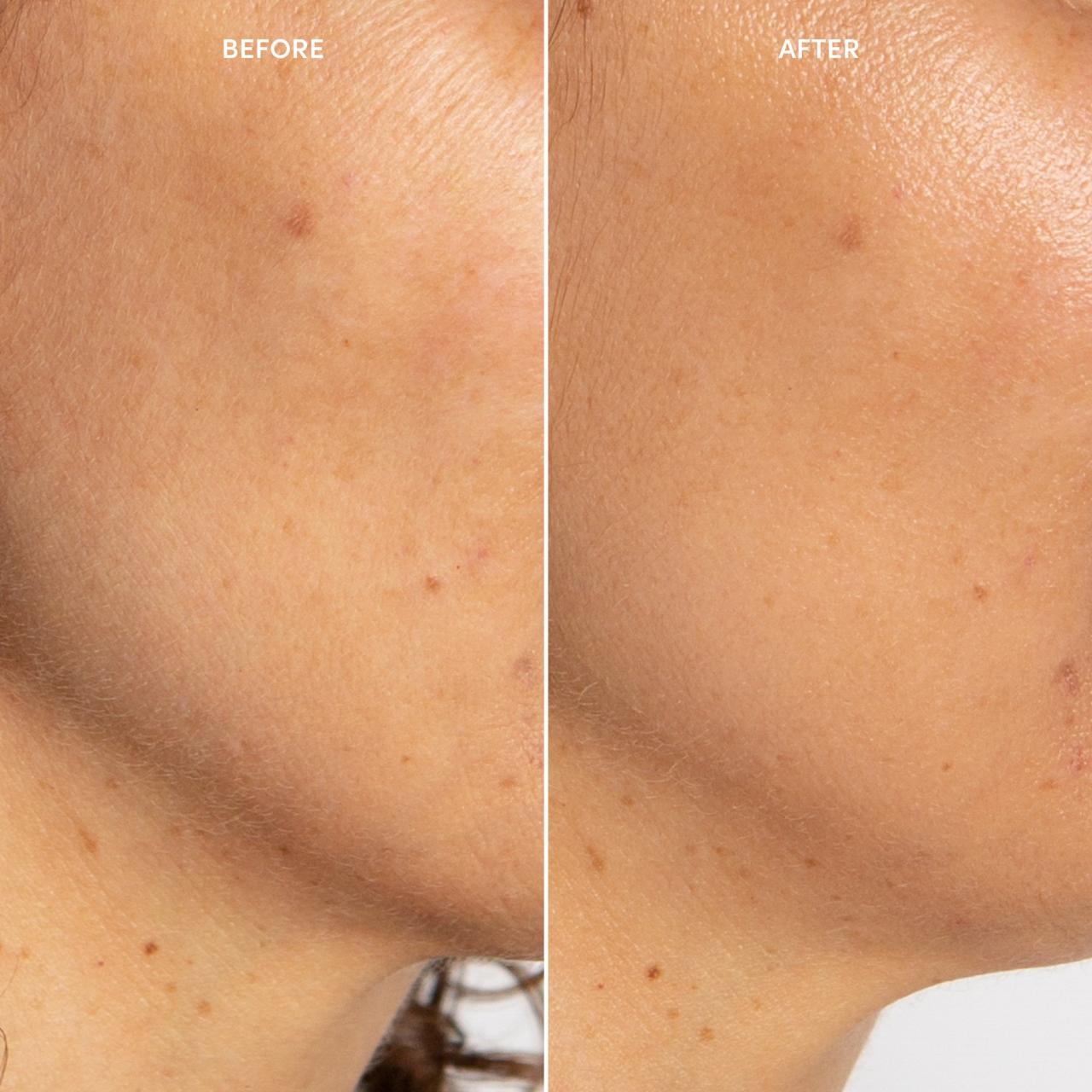 Egf serums commission affiliate contains Egf serums commission affiliate contains