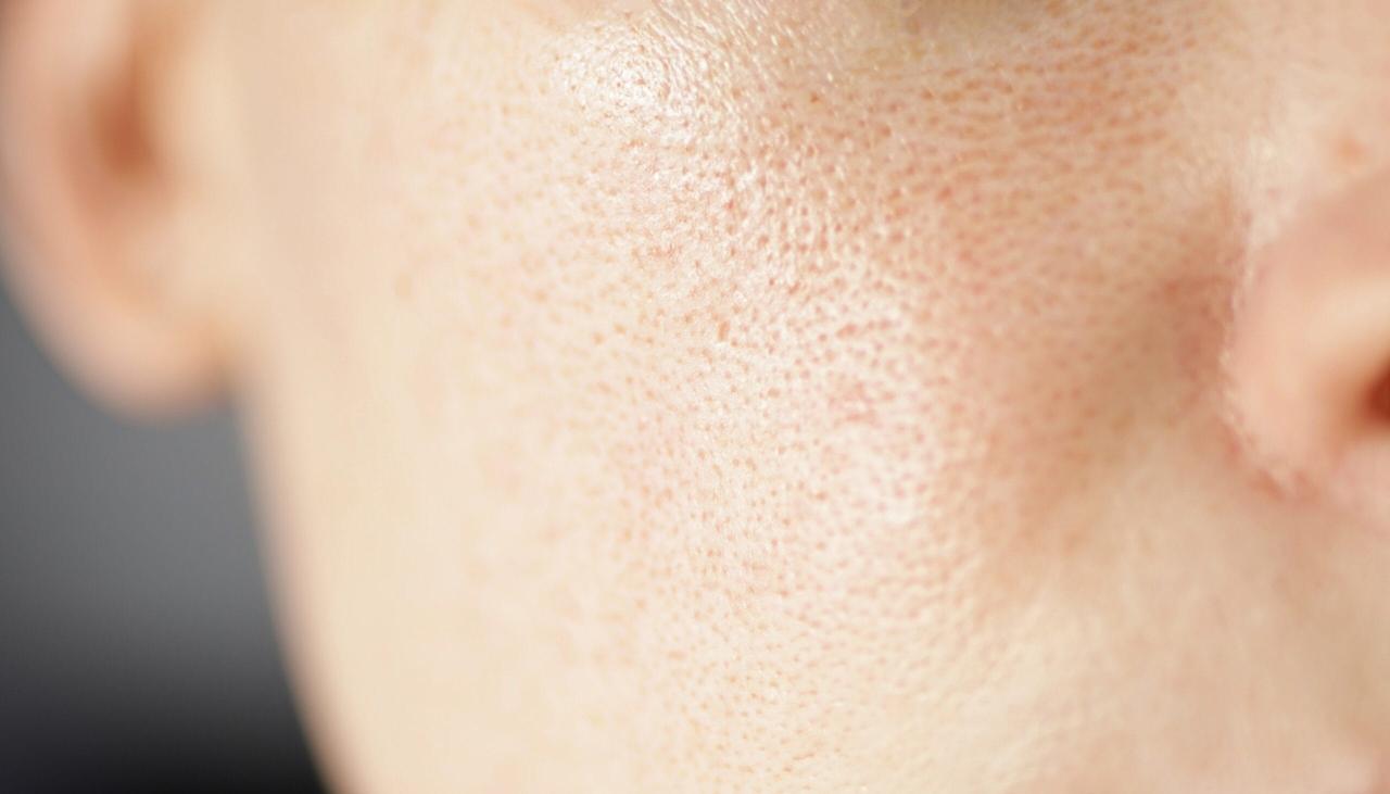Does cleansing oil clog pores or cause breakouts